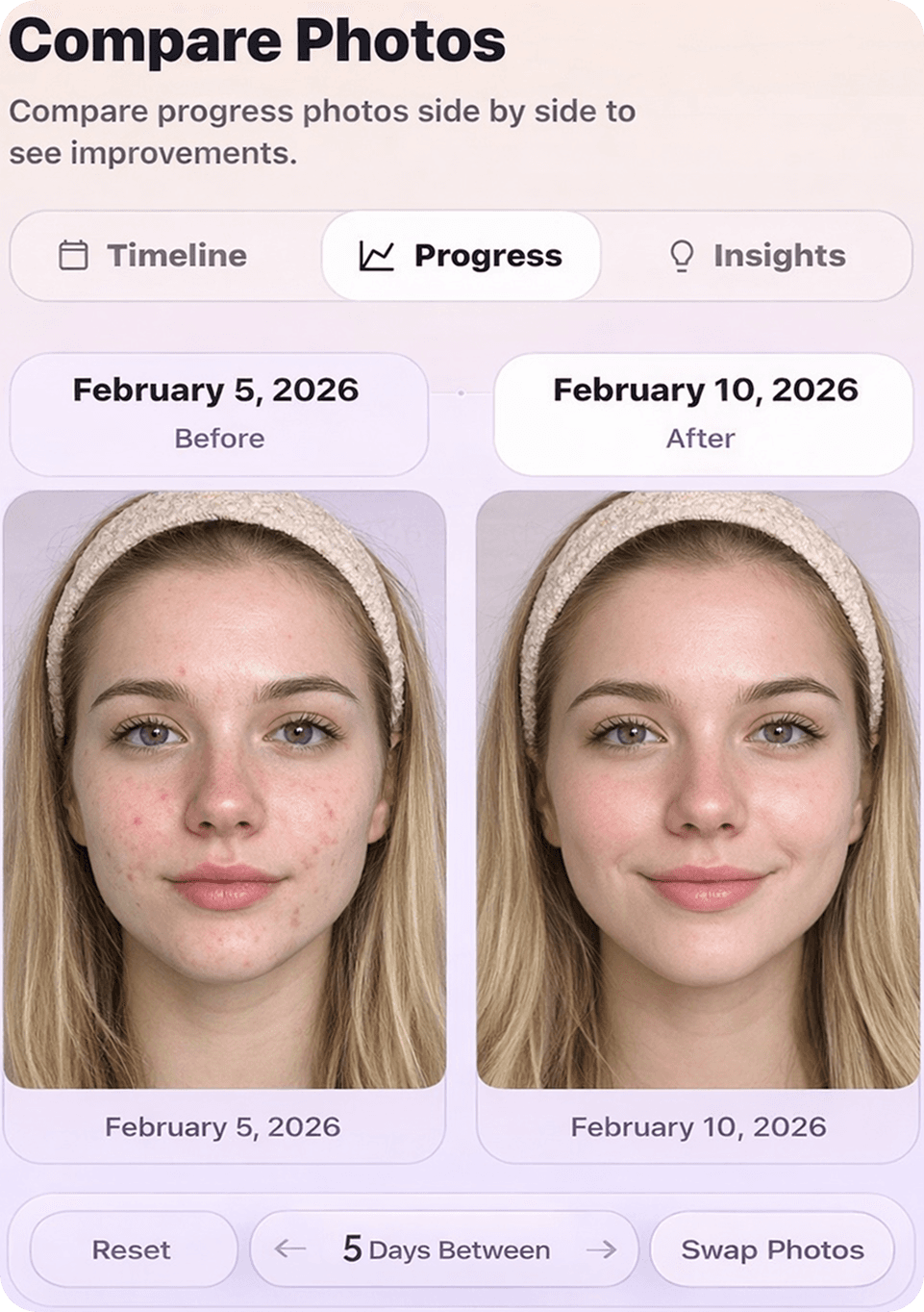 SkinsideAI photo comparison screen